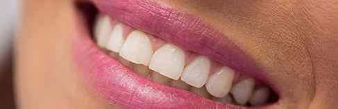 Sorriso di una donna